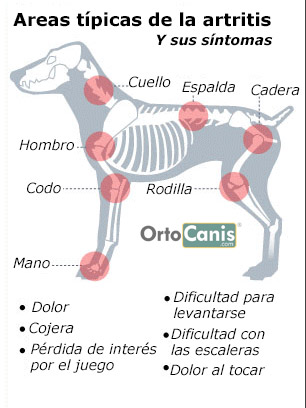 Artritis-y-sintomas