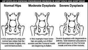 Hip displasia degrees