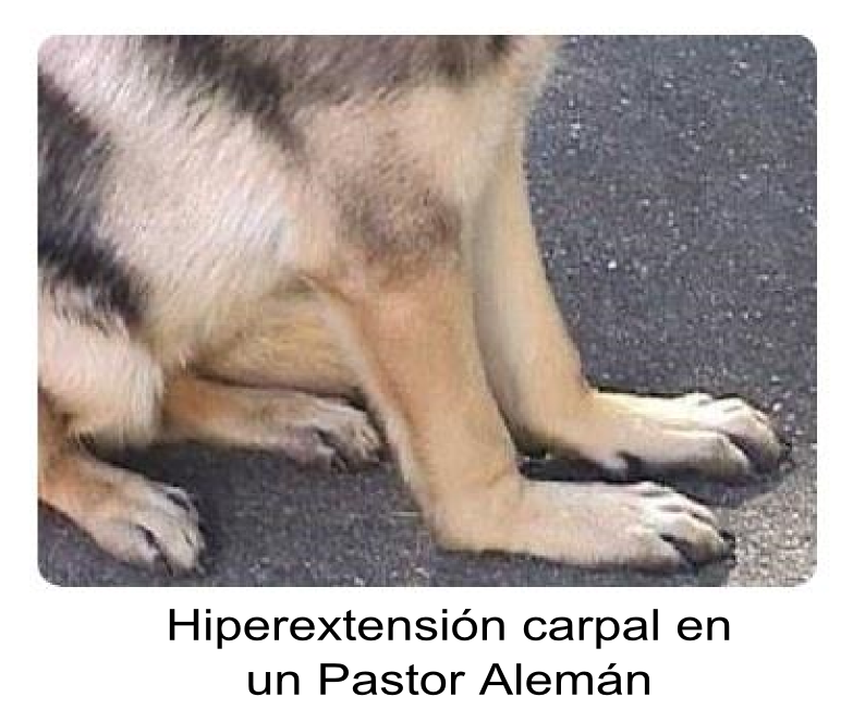Carpal hyperextension