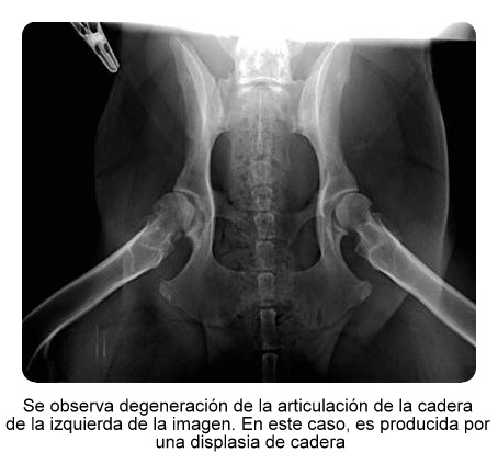 Radiografía artrosis