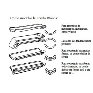 Moldable splint