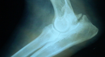 Elbow dysplasia in dogs