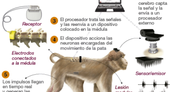 Neuroscientists get a paralyzed animal back to walk with a bypass in the spinal cord