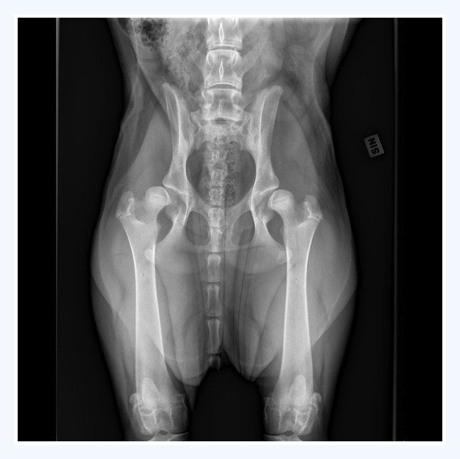 Dysplasia x-ray