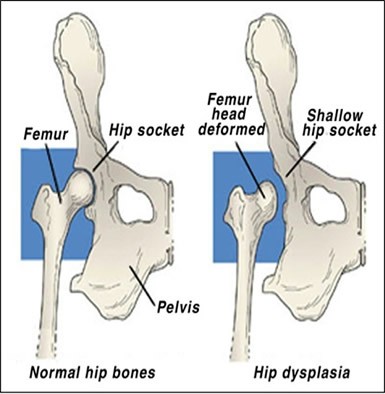 dog hip dysplasia diagram