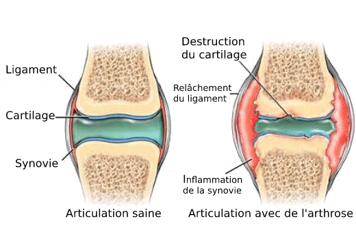 Destruction du cartilage Chien avec arthrose