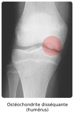 Osteocondritis dissecans en húmero de perro