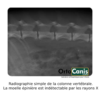 Radiographie simple de la colonne vertébrale