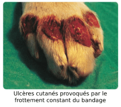 Ulcères cutanés bandage