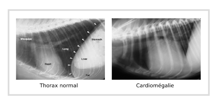 Radiographie thorax normal et cardiomégalie