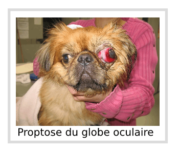 Proptose du globe oculaire