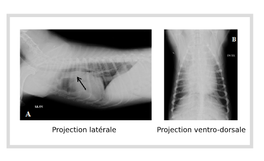 Radiographie bidimensionnelle