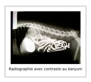 Radiographie avec contraste au baryum