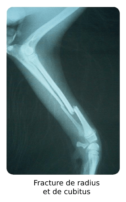 Fracture de radius et de cubitus d'un chien