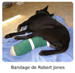 Bandage Robert Jones