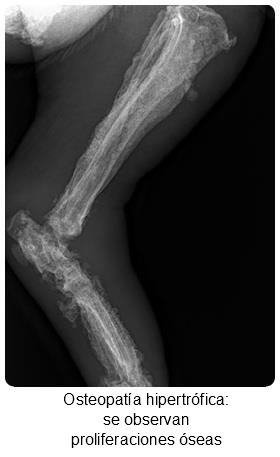 hypertrophische osteodystrophie