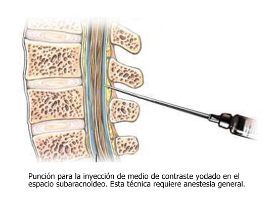 Contraste yodado