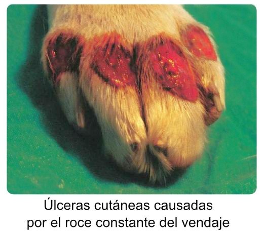 Skin ulcer from cast
