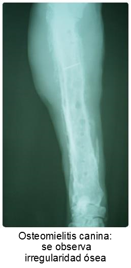 Osteomyelitis caused by infection